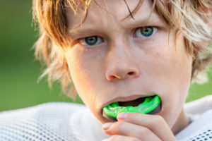 Mouth Guard Picture