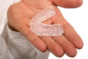mouth-guards-for-teeth-grinding