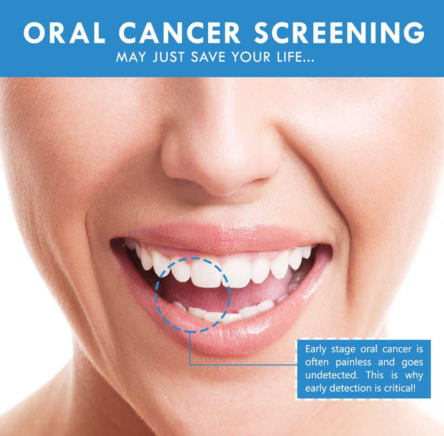 oral-cancer-screening