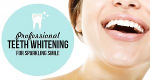 professional-teeth-whitening